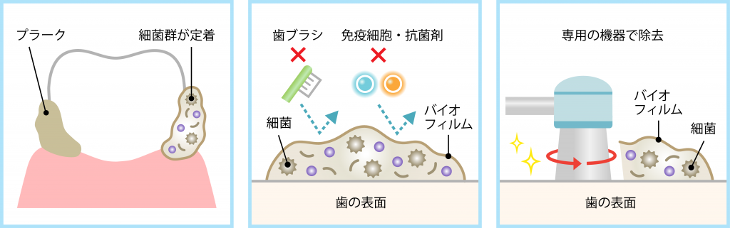 PMTC
